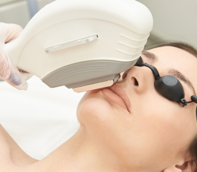 Laser Pigmentaire 165d0f52