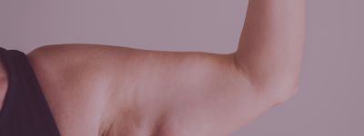 brachioplastie