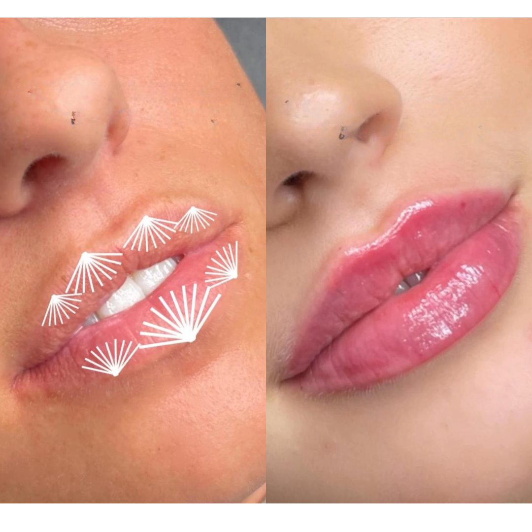 Offre 2 russian lips