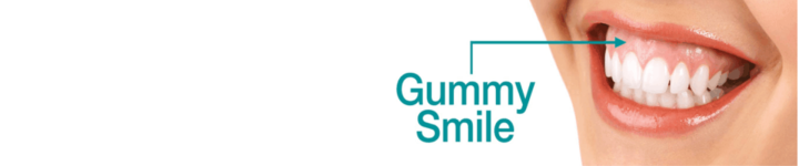 Gummy SMile