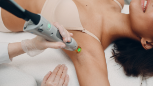 Epilation Laser