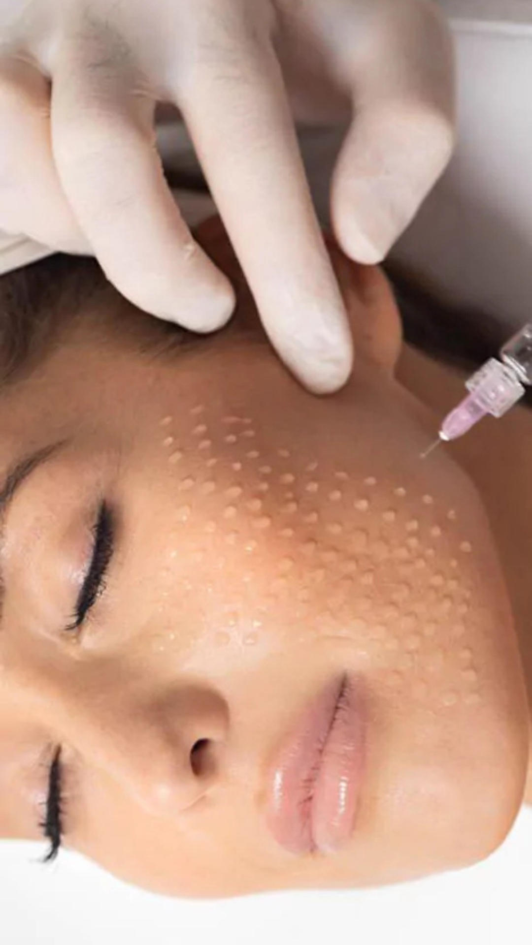 Skinbooster