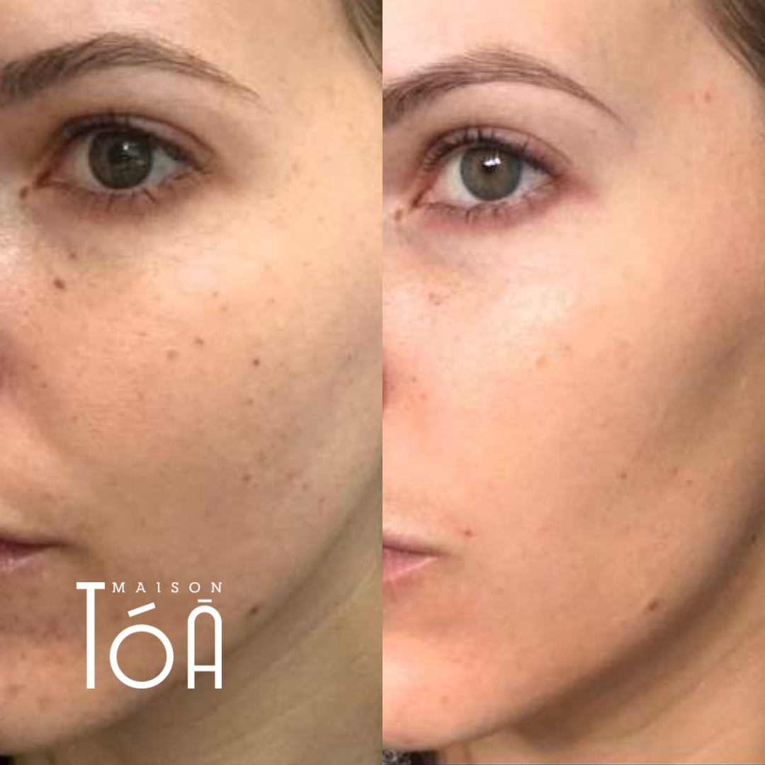 Skinbooster