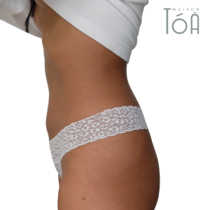 Liposuction 3 7 b25c7fbc
