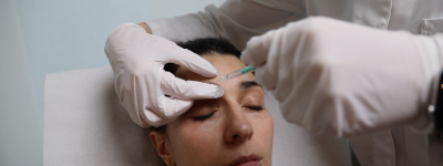 Injection botox lausanne