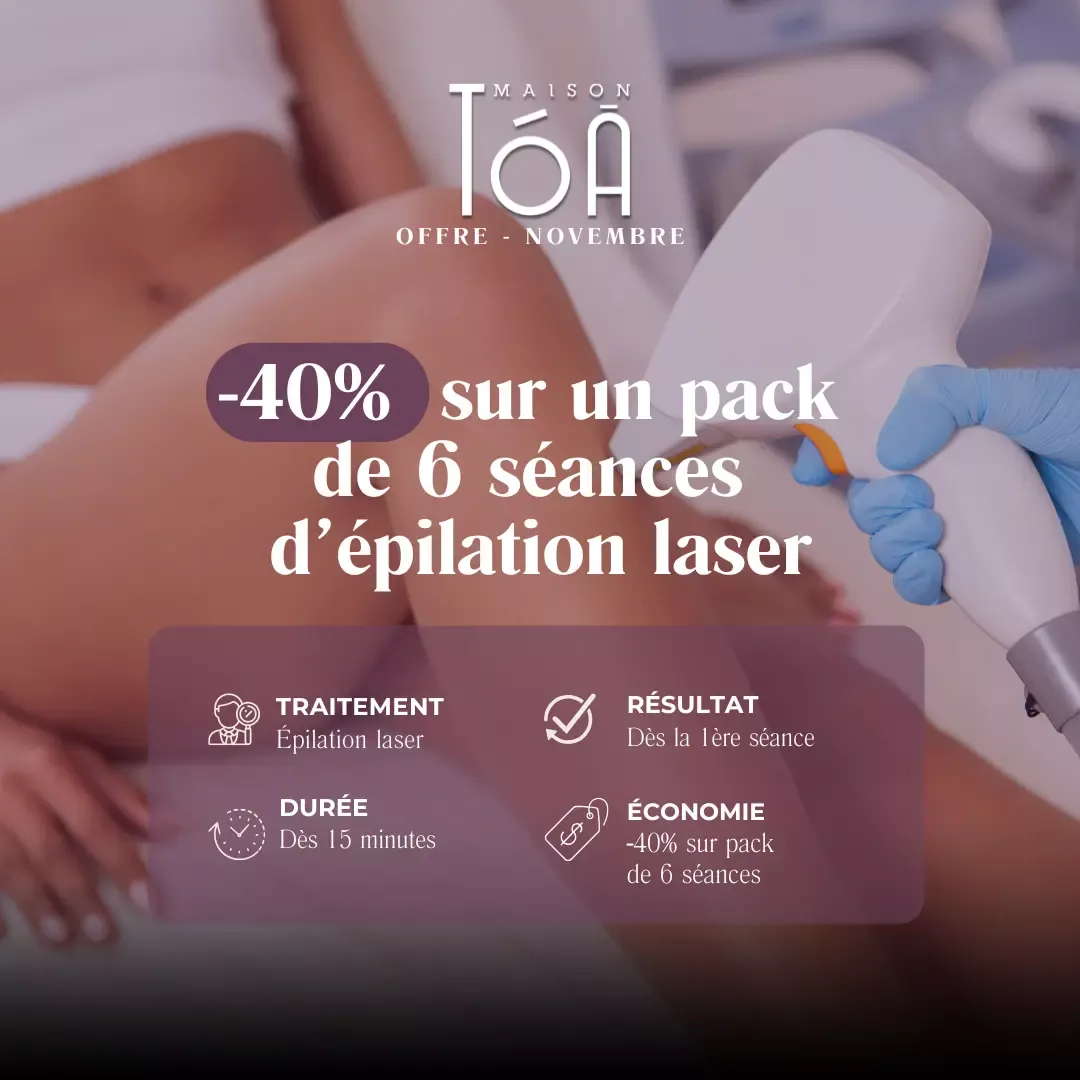 offre epilation laser