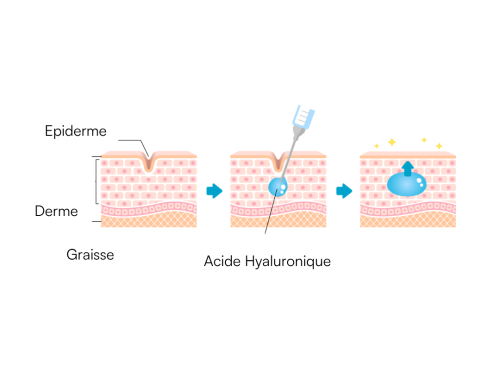 skinbooster