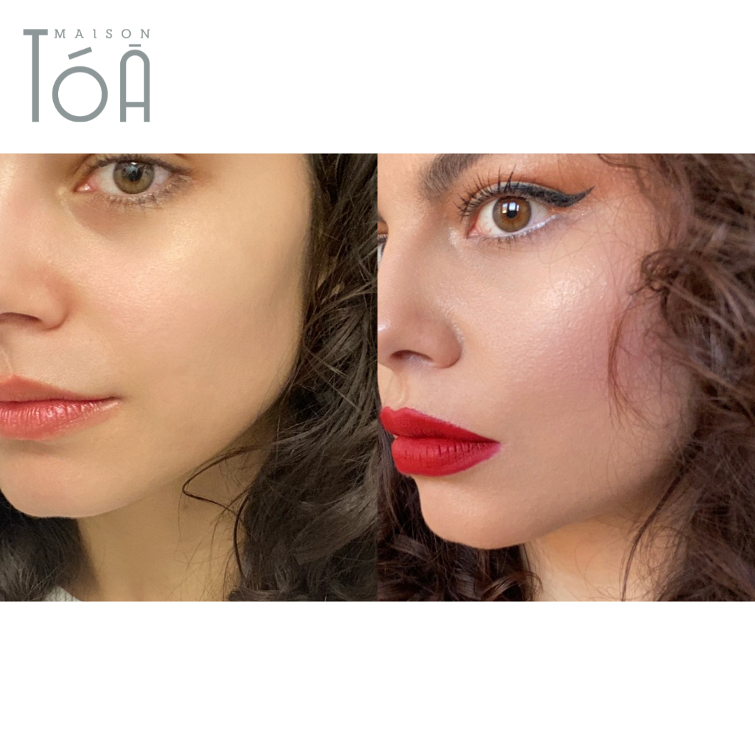 Acide Hyaluronique pour les yeux : Solution pour cernes et regard fatigué 8 acide hyaluronique yeux