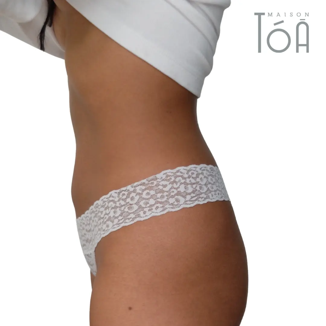 liposuccion lausanne