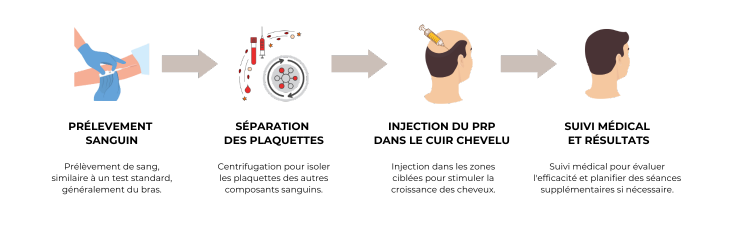 injection autologue