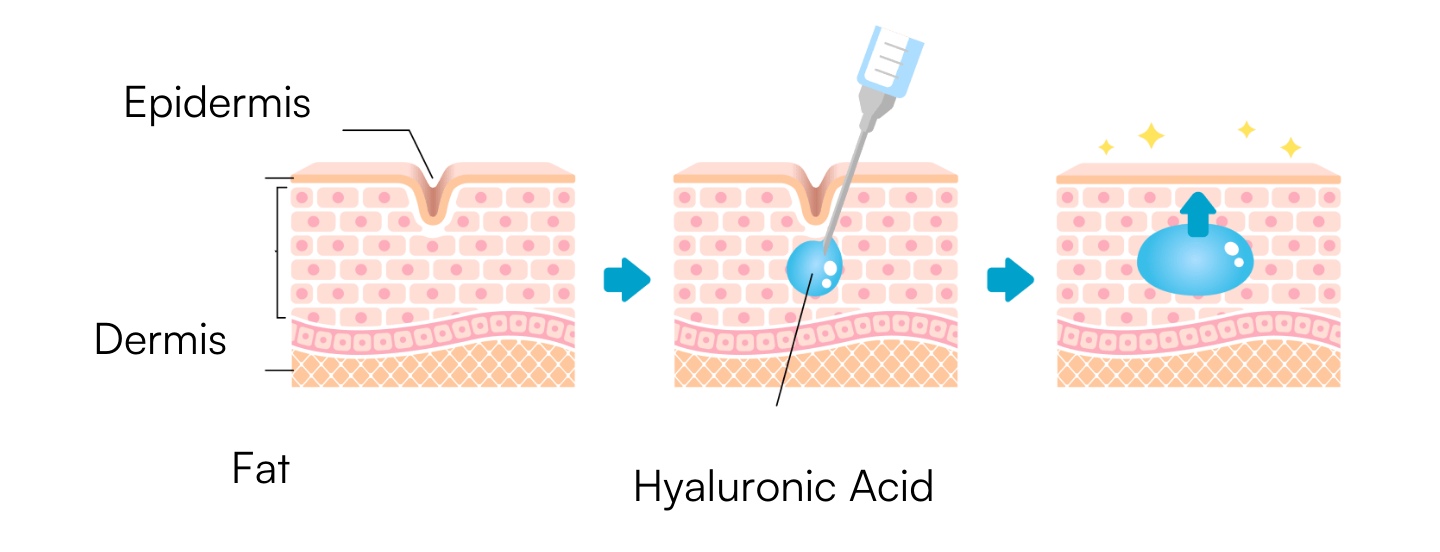 skinbooster