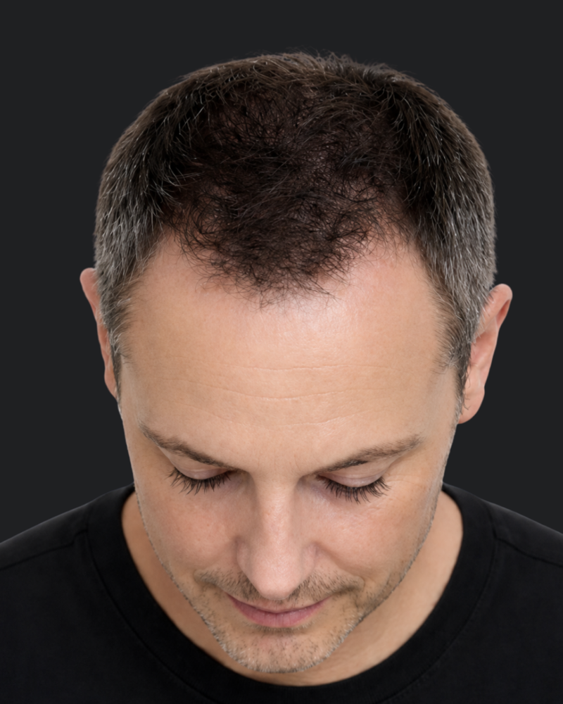 Exosomes - Cheveux 4 2 4 e1784216376362