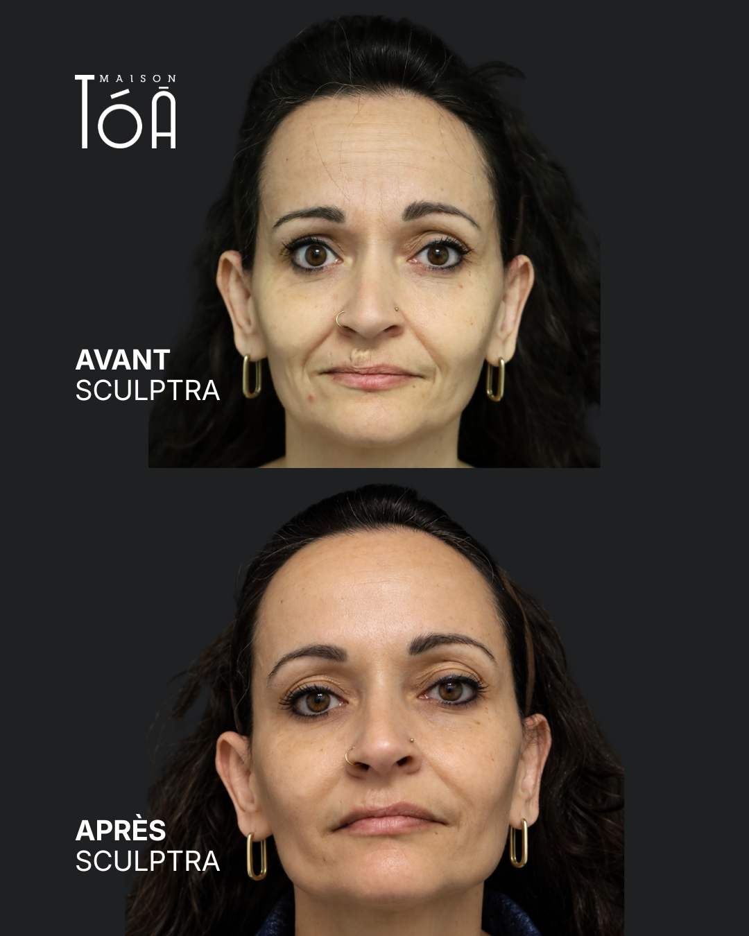 Avant Après scuptra 