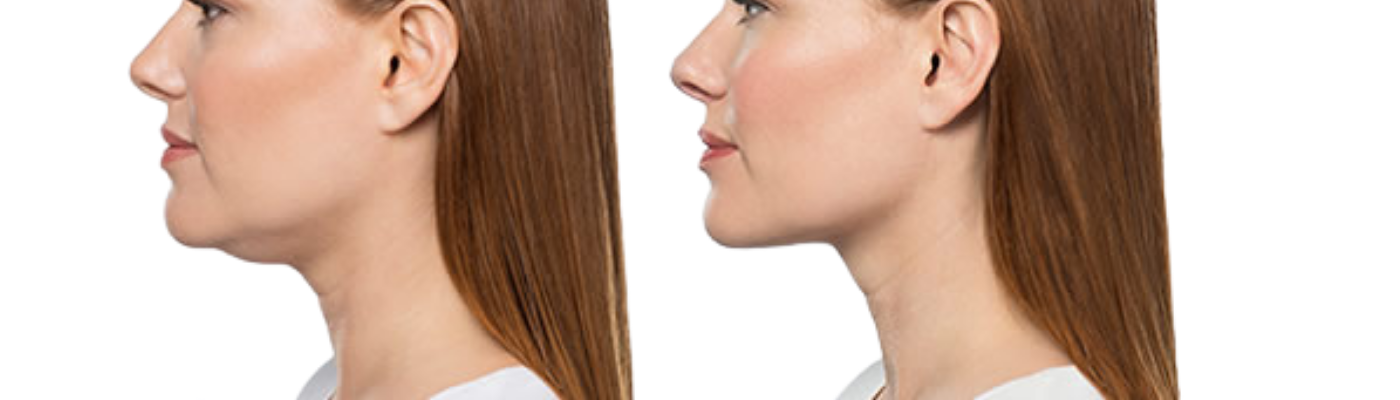 Photo site traitements 1920 x 400 11