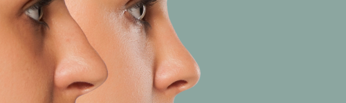 Photo site traitements 1920 x 400 14