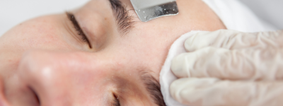 peeling medicale solaires