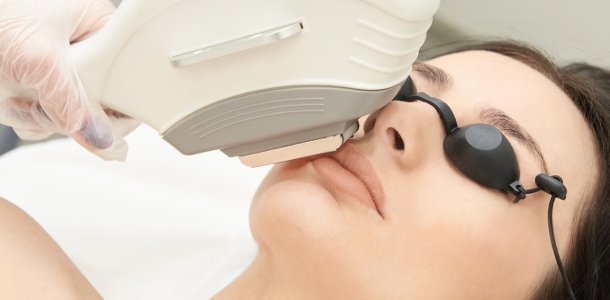 Acide Hyaluronique 87 Laser Pigmentaire