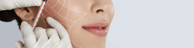 lifting du visage