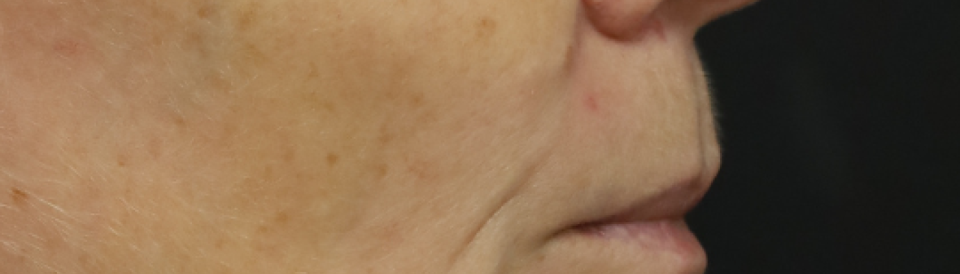 2 2 e1656007658567