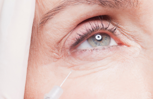 Médecine esthétique à 50 ans