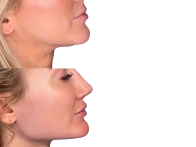 jawline