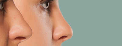 Photo site traitements 1920 x 400 14