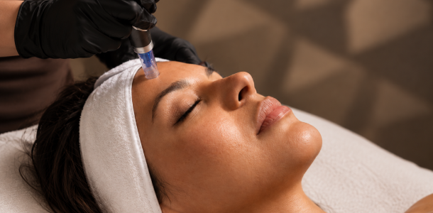 Collagen Reset 1 vampire lift