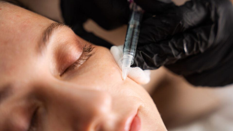 Injection de Skinbooster en micro-papules, Maison Tóā Lausanne