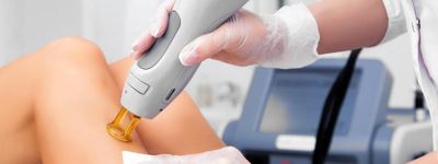 epilation laser prix