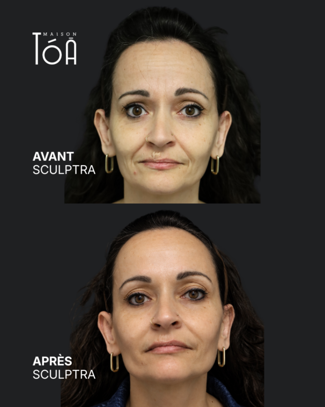 Avant Après scuptra 