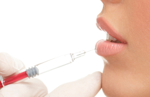 augmentation lèvre