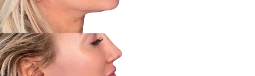 jawline