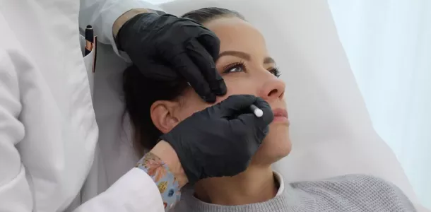 profhilo lausanne scaled scaled