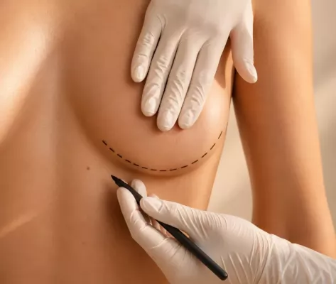 chirurgie esthétique Lausanne, marquage pré-opératoire