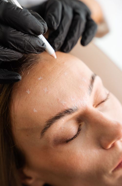 Botox 1 Toxine botulique (Botox®) à Lausanne, Maison Tóā
