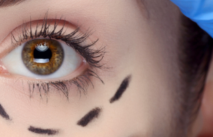 lifting sourcil
