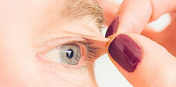 chirurgie paupieres blepharoplastie