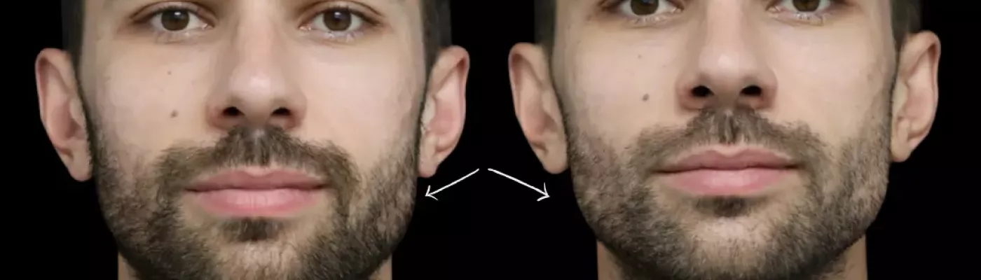 injection homme