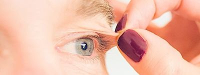 Blépharoplastie Lausanne