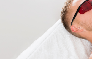 épilation laser homme