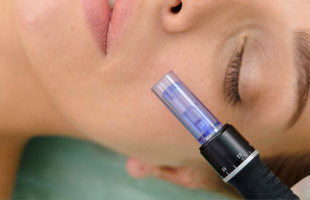 microneedling en suisse