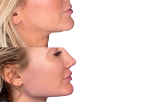 jawline