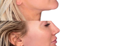 jawline