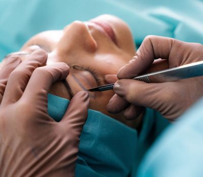 Augmentation mammaire 9 A7403542 chir bleph scaled e1787050358648