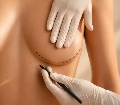 chirurgie esthétique Lausanne, marquage pré-opératoire