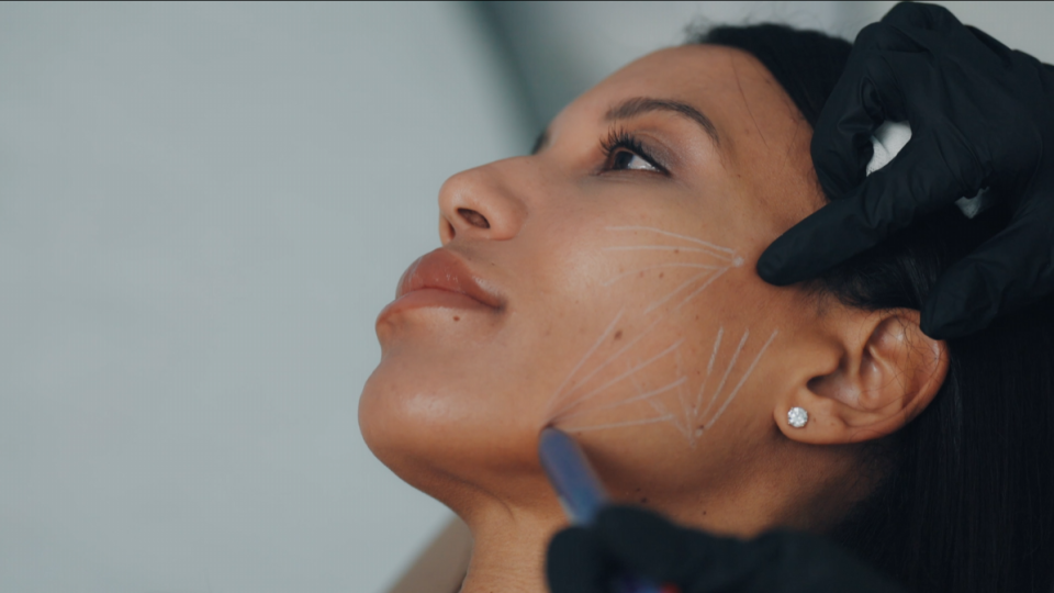 Radiesse 2 Consultation médicale avant une injection de Radiesse®, Maison Tóā Lausanne