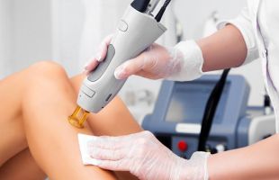 epilation laser prix