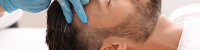 Alopécie et chute de cheveux : quelles solutions médicales 3 prp