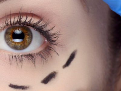 lifting sourcil