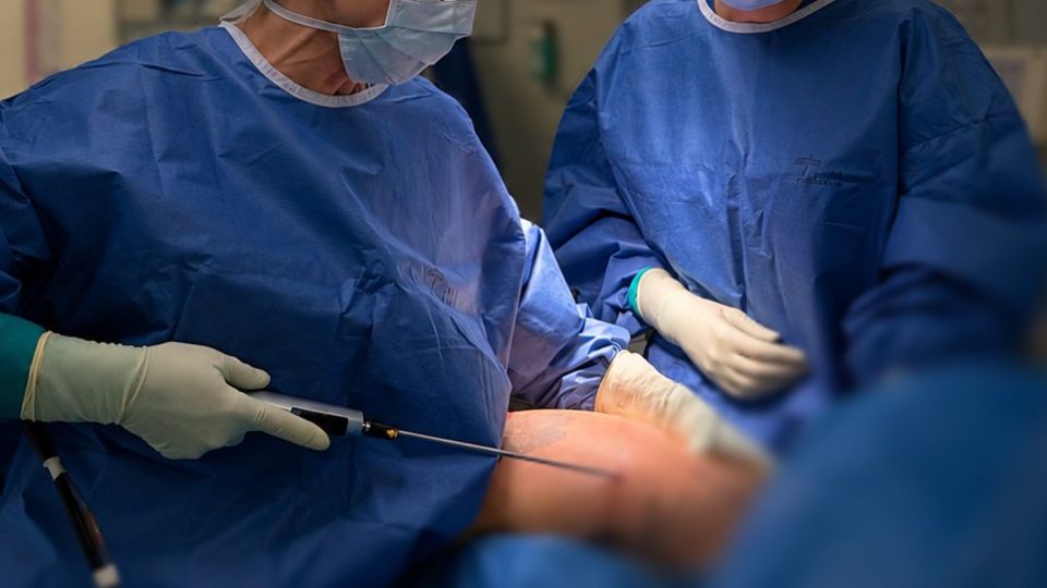 Lipofilling mammaire lausanne